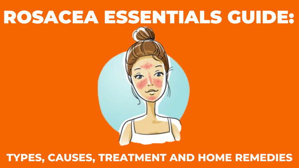 Rosacea Essentials Guide: Types, Causes, Treatment and Home Remedies - cleure