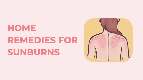 12 Home Remedies for Sunburns
