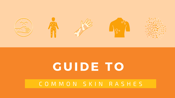 guide to common skin rashes