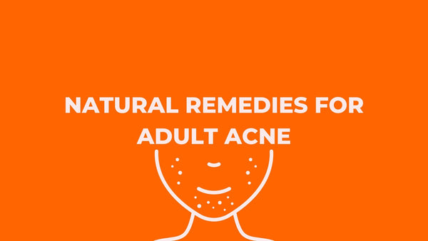 Natural Remedies for Adult Acne Prone Skin