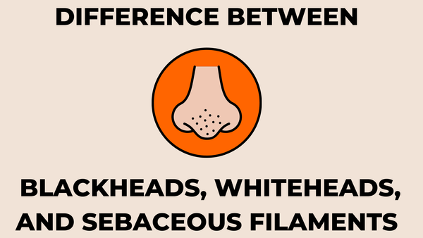 difference between blackheads, whiteheads, and sebaceous filaments