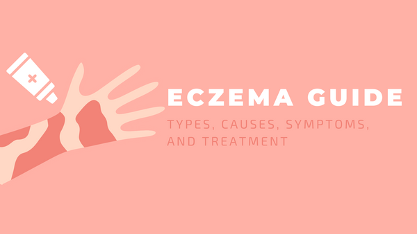 eczema guide: types, causes, symptoms, treatment