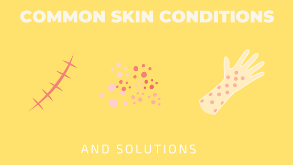 common skin conditions and solutions
