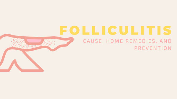 folliculitis cause home remedies and prevention